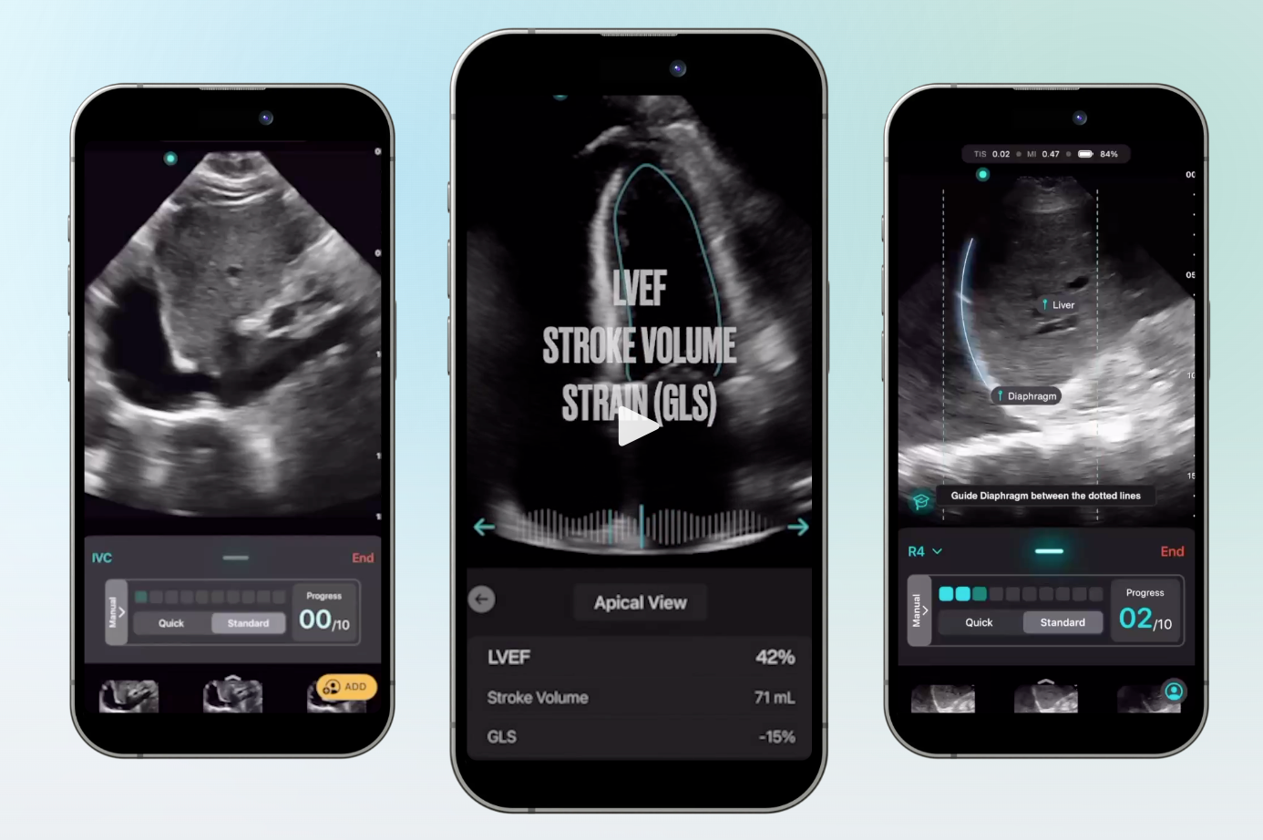 AI-powered ultrasound mobile app by Lickability